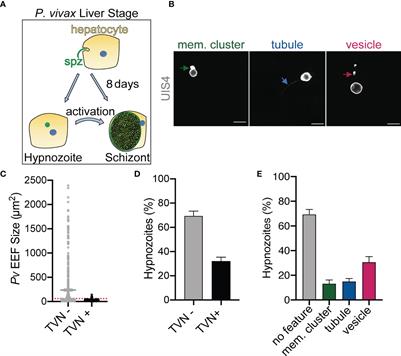 Characterization of the Tubovesicular Network in Plasmodium vivax Liver Stage Hypnozoites and Schizonts